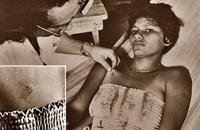 Medical Records of Beam Attack Victims